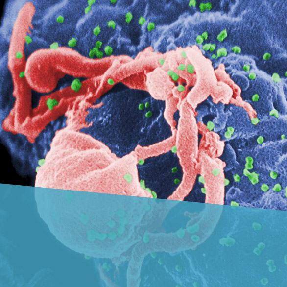 HIV virus